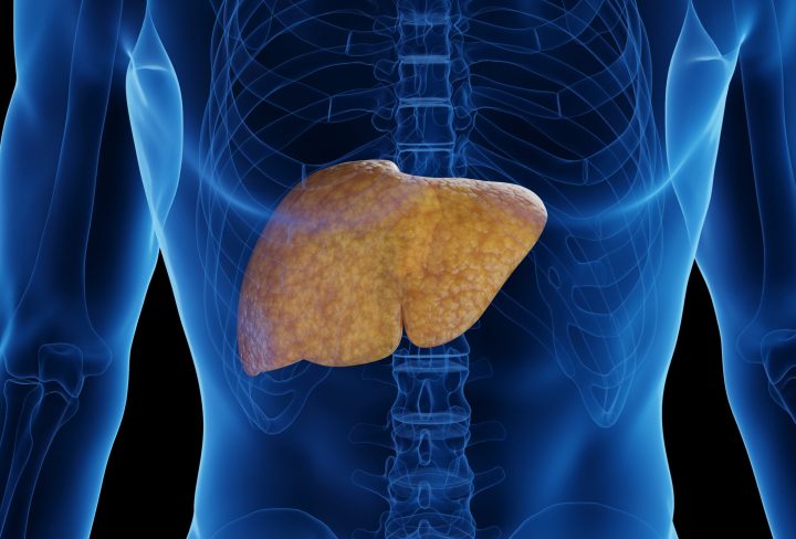 3D rendered medical illustration of male anatomy - fatty liver. plain black background. professional studio lighting. anterior view